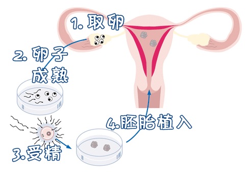 林主任